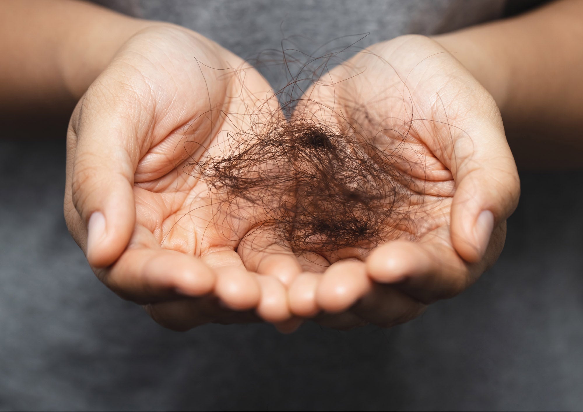 Thinning Hair